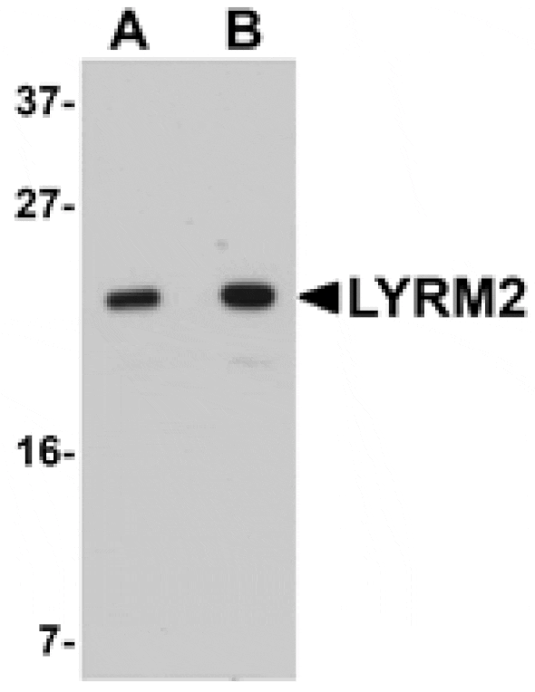 Western blot - LYRM2 Antibody from Signalway Antibody (25079) - Antibodies.com