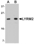 Western blot - LYRM2 Antibody from Signalway Antibody (25079) - Antibodies.com