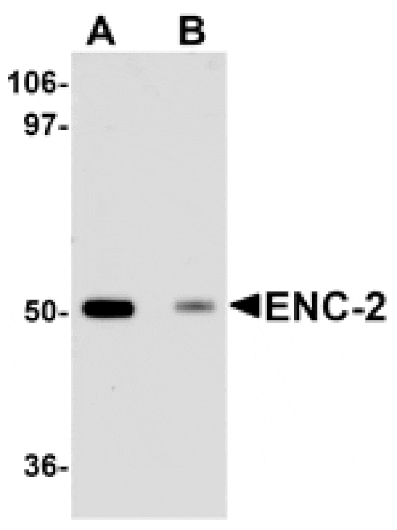 Western blot - ENC-2 Antibody from Signalway Antibody (25095) - Antibodies.com