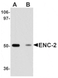 Western blot - ENC-2 Antibody from Signalway Antibody (25095) - Antibodies.com