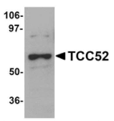 Western blot - TCC52 Antibody from Signalway Antibody (25097) - Antibodies.com