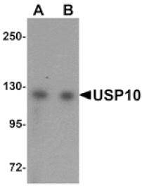 Western blot - USP10 Antibody from Signalway Antibody (25134) - Antibodies.com