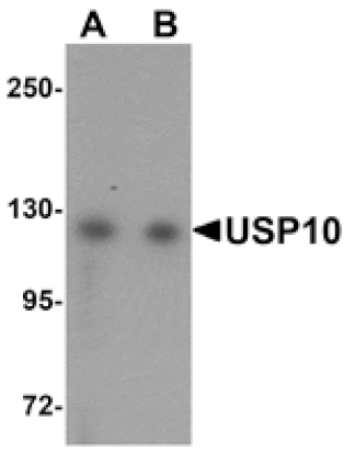 Western blot - USP10 Antibody from Signalway Antibody (25134) - Antibodies.com