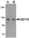 Western blot - USP10 Antibody from Signalway Antibody (25134) - Antibodies.com