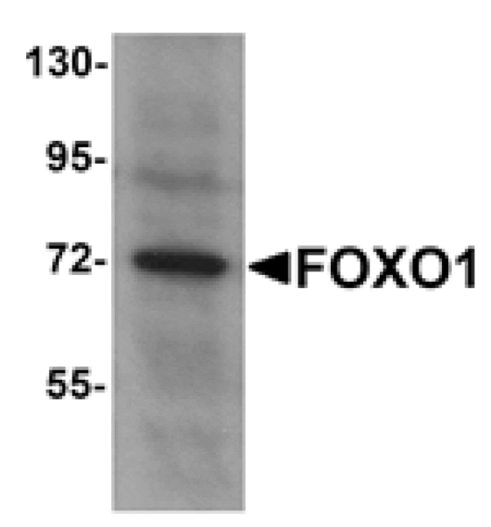 Western blot - FOXO1 Antibody from Signalway Antibody (25137) - Antibodies.com