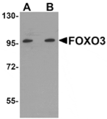 Western blot - FOXO3 Antibody from Signalway Antibody (25138) - Antibodies.com