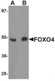 Western blot - FOXO4 Antibody from Signalway Antibody (25139) - Antibodies.com