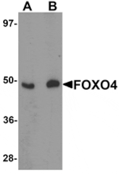 Western blot - FOXO4 Antibody from Signalway Antibody (25139) - Antibodies.com
