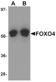 Western blot - FOXO4 Antibody from Signalway Antibody (25140) - Antibodies.com