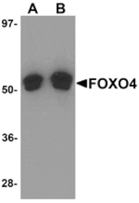 Western blot - FOXO4 Antibody from Signalway Antibody (25140) - Antibodies.com