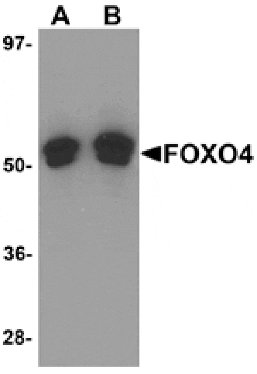 Western blot - FOXO4 Antibody from Signalway Antibody (25140) - Antibodies.com
