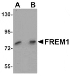 Western blot - FREM1 Antibody from Signalway Antibody (25146) - Antibodies.com