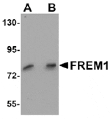 Western blot - FREM1 Antibody from Signalway Antibody (25146) - Antibodies.com