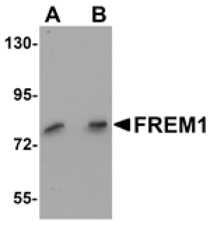 Western blot - FREM1 Antibody from Signalway Antibody (25146) - Antibodies.com