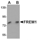 Western blot - FREM1 Antibody from Signalway Antibody (25146) - Antibodies.com