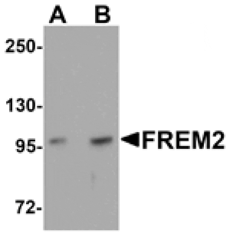 Western blot - FREM2 Antibody from Signalway Antibody (25147) - Antibodies.com