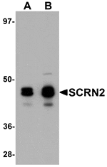 Western blot analysis of SCRN2 in 293 cell tissue lysate with SCRN2 antibody at (A) 0.5 and (B) 1 µg/mL.