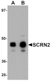 Western blot - SCRN2 Antibody from Signalway Antibody (25155) - Antibodies.com