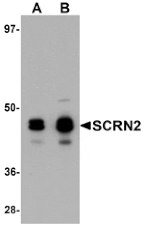Western blot - SCRN2 Antibody from Signalway Antibody (25155) - Antibodies.com