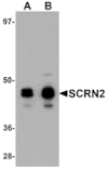 Western blot - SCRN2 Antibody from Signalway Antibody (25155) - Antibodies.com