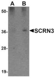 Western blot - SCRN3 Antibody from Signalway Antibody (25156) - Antibodies.com