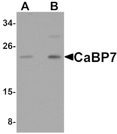 Western blot - CaBP7 Antibody from Signalway Antibody (25159) - Antibodies.com