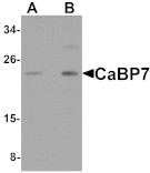 Western blot - CaBP7 Antibody from Signalway Antibody (25159) - Antibodies.com