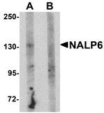 Western blot analysis of NALP5 in mouse brain tissue lysate with NALP5 antibody at 1 µg/mL in (A) the absence and (B) the presence of blocking peptide.