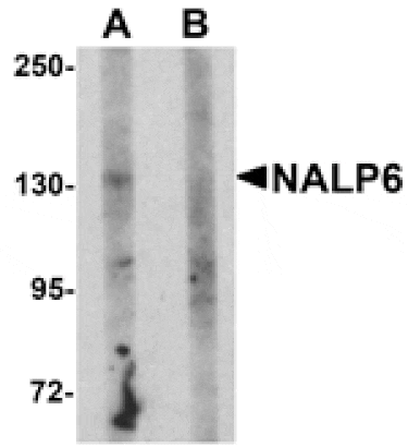 Western blot - NALP6 Antibody from Signalway Antibody (25181) - Antibodies.com