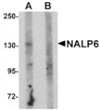 Western blot - NALP6 Antibody from Signalway Antibody (25181) - Antibodies.com