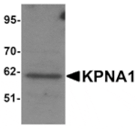Western blot - KPNA1 Antibody from Signalway Antibody (25191) - Antibodies.com