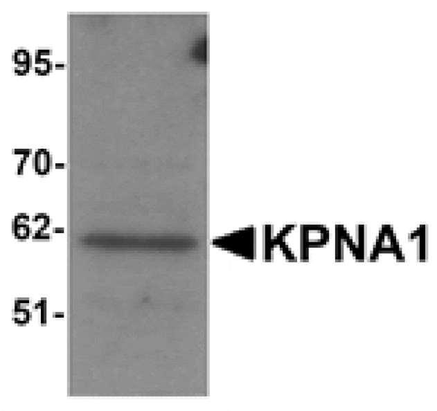 Western blot - KPNA1 Antibody from Signalway Antibody (25191) - Antibodies.com