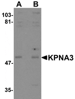 Western blot analysis of KPNA3 in EL4 cell lysate with KPNA3 antibody at (A) 1 and (B) 2 µg/mL.