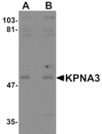 Western blot - KPNA3 Antibody from Signalway Antibody (25193) - Antibodies.com