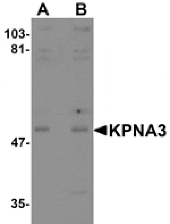 Western blot - KPNA3 Antibody from Signalway Antibody (25193) - Antibodies.com