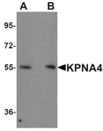 Western blot - KPNA4 Antibody from Signalway Antibody (25194) - Antibodies.com
