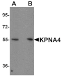 Western blot - KPNA4 Antibody from Signalway Antibody (25194) - Antibodies.com