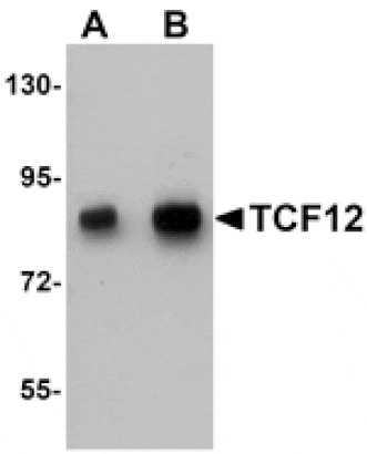 Western blot - TCF12 Antibody from Signalway Antibody (25198) - Antibodies.com