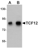 Western blot - TCF12 Antibody from Signalway Antibody (25198) - Antibodies.com