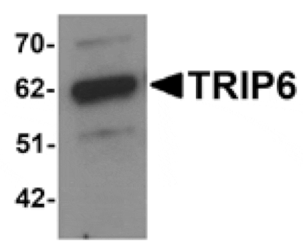 Western blot - TRIP6 Antibody from Signalway Antibody (25199) - Antibodies.com