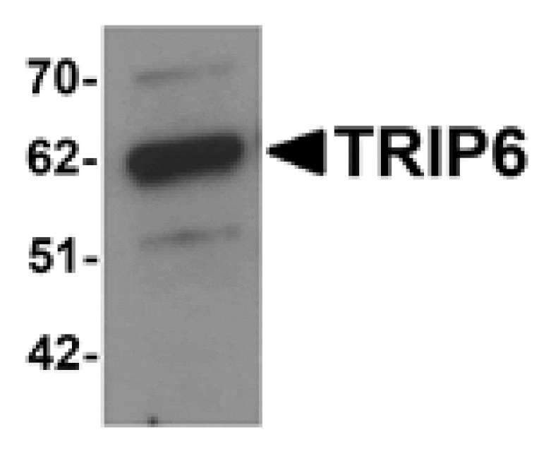 Western blot - TRIP6 Antibody from Signalway Antibody (25199) - Antibodies.com