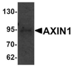 Western blot - AXIN1 Antibody from Signalway Antibody (25201) - Antibodies.com
