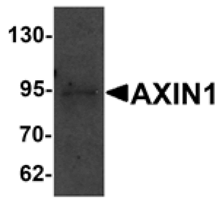 Western blot - AXIN1 Antibody from Signalway Antibody (25201) - Antibodies.com