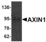 Western blot - AXIN1 Antibody from Signalway Antibody (25201) - Antibodies.com