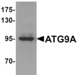 Western blot - ATG9A Antibody from Signalway Antibody (25202) - Antibodies.com