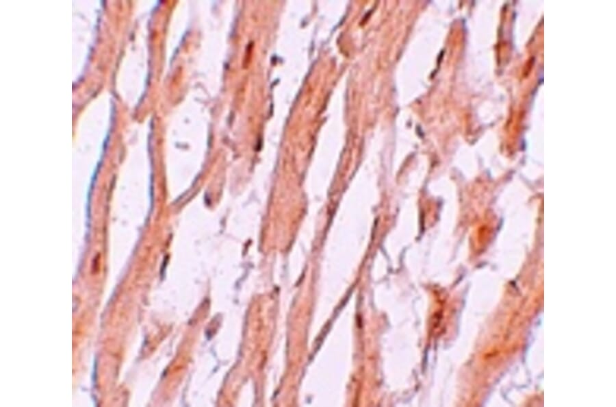 Immunohistochemistry - ATG9A Antibody from Signalway Antibody (25202) - Antibodies.com