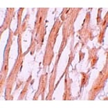 Immunohistochemistry - ATG9A Antibody from Signalway Antibody (25202) - Antibodies.com