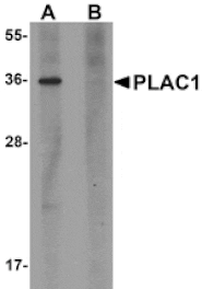 Western blot - PLAC1 Antibody from Signalway Antibody (25203) - Antibodies.com