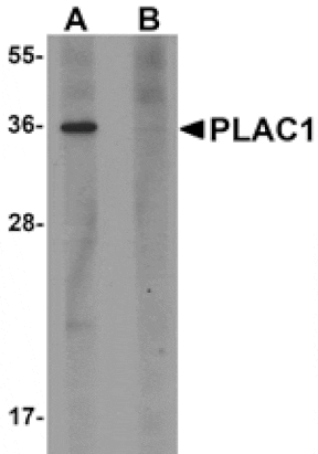 Western blot - PLAC1 Antibody from Signalway Antibody (25203) - Antibodies.com