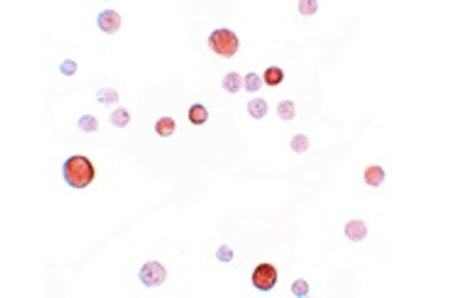 Immunocytochemistry - PLAC1 Antibody from Signalway Antibody (25203) - Antibodies.com